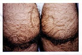 Click image for larger version

Name:	hairy butt.jpg
Views:	21
Size:	11.0 KB
ID:	596568